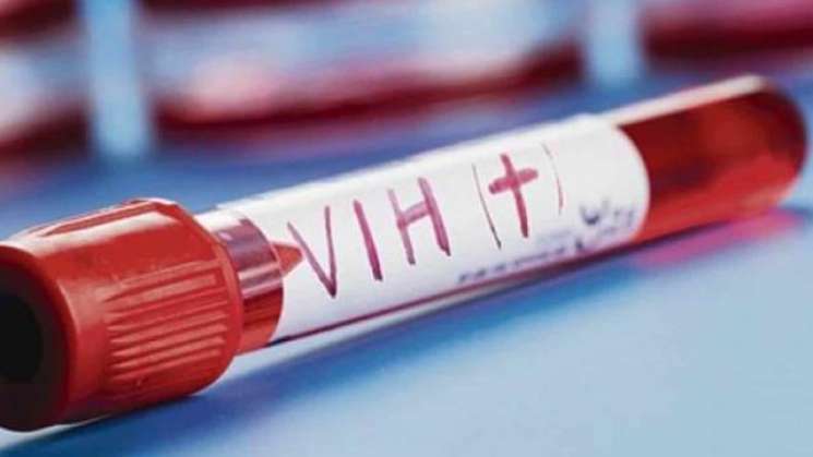 Científicos franceses descubren cura contra el HIV