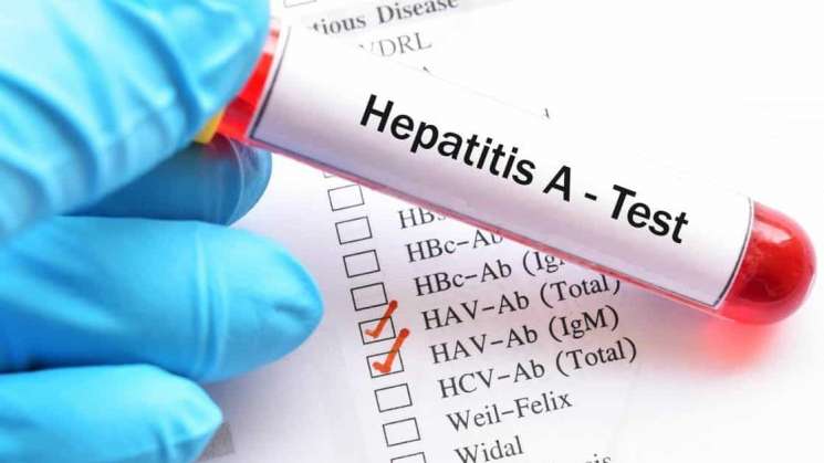 En México, aumentan casos de hepatitis A en niños
