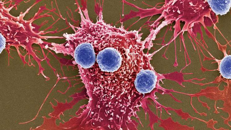 Desarrollan científicos virus para curar el cáncer
