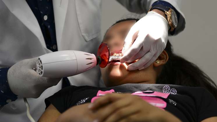 Sufren de caries nueve de cada 10 oaxaqueños: SSO