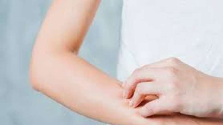 IMSS llama a protegerse del frío y prevenir enfermedades en piel