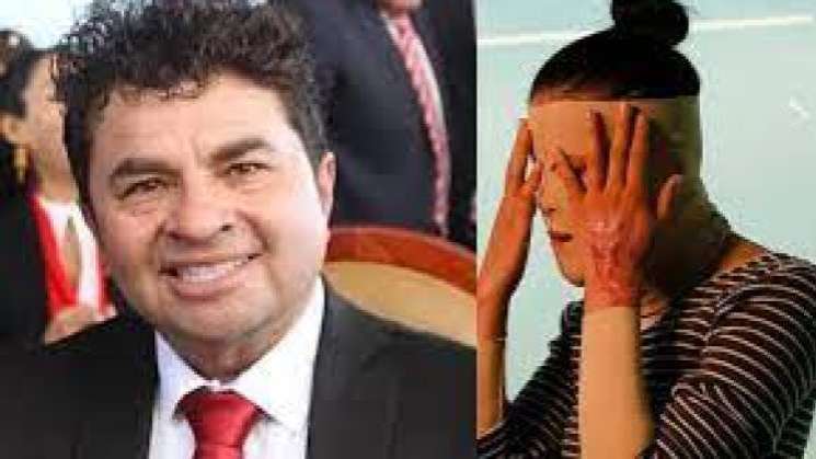 Agresor de saxofonista permanecerá en prisión: FGEO