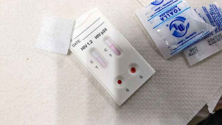  Instalan punto de detección de VIH, hepatitis y sífilis 