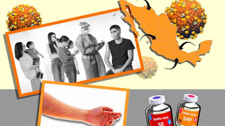 Registra México primera muerte por actual brote de sarampión