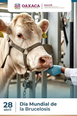 Recomiendan evitar consumo de productos lácteos sin pasteurizar