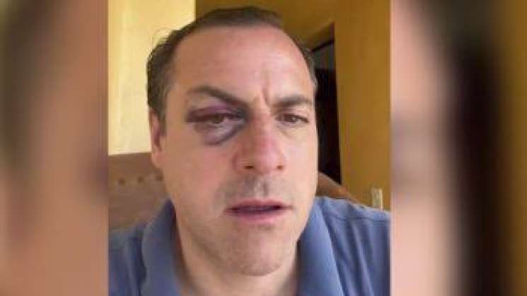 En Oaxaca, taxista agrede y asalta a turista británico 