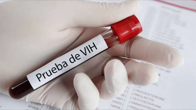  Aumentan en Oaxaca casos reactivos con VIH, ocupa 9° Lugar